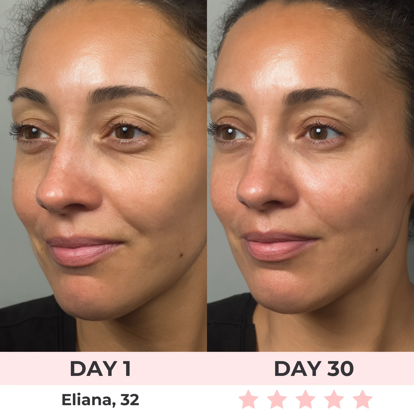 Lume Red Light Under-Eye Glasses